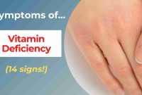What Are The Signs Of Vitamin Deficiency Unveiled